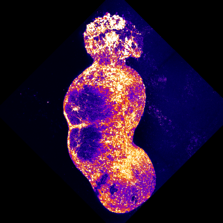 Researchers created an assembloid by integrating four organoids representing components of the human sensory pathway.